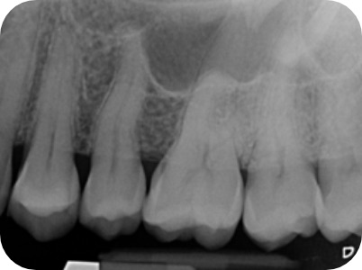 Claudio Farnararo Endodonzia | Traumi